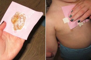 Treat Cough And Remove Mucus From Lungs in One Night With Wrapped Ginger