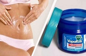 15 Vicks VapoRub Uses: Treat Stretch Marks, Eczema And More