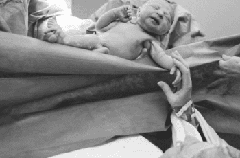 Everyone Should Know These 3 Truths About C-Section Mothers