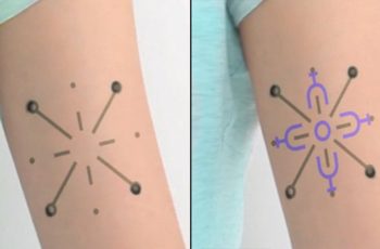Innovative Biosensing Tattoo Changes Color When Blood Sugar Levels Change