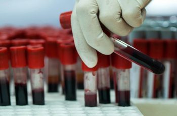 New Blood Test Detects Cancer Before Symptoms Start