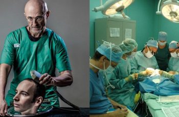 Doctor Claims He’ll Perform First Human Head Transplant After Successful Operation On A Cadaver