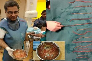 Sunita roundworms removal surgery