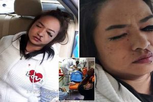 Woman Gets Eyeliner Lodged In Eye While In Taxi Which Later Crashed