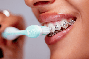 The Best Toothpaste for Braces