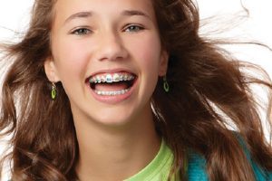 Here Are Some of our Tips To Help Cope Your Teens with Braces