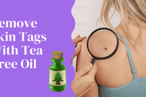 Remove Skin Tags With Tea Tree Oil