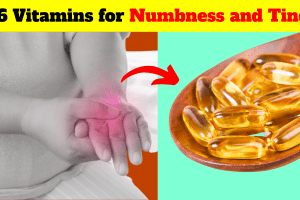 Top 6 Vitamins for Numbness and Tingling in 2022