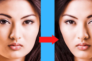 how to get rid of chubby cheeks