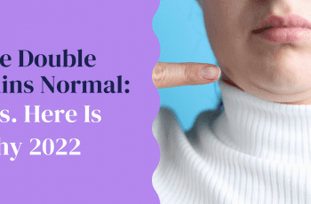 Are Double Chins Normal: Yes. Here Is Why 2022