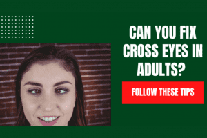Can You Fix Cross Eyes In Adults? Follow These Tips 2022