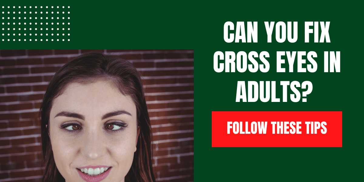 Can you fix cross eyes in adults