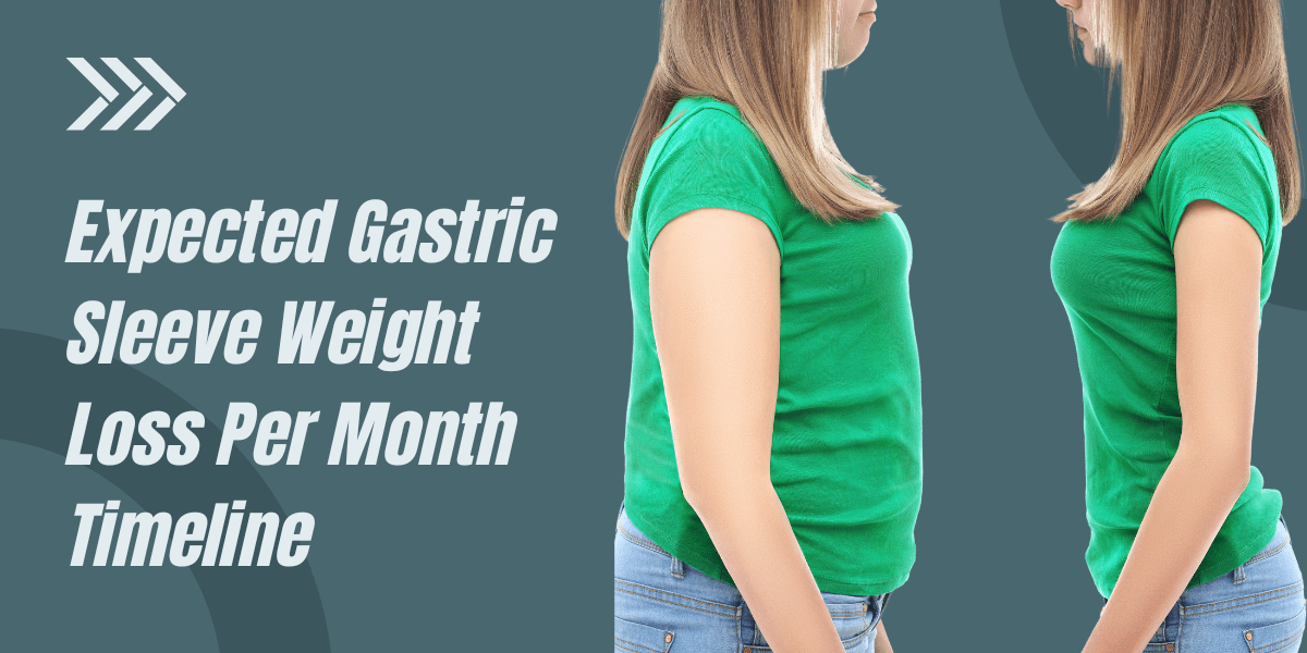 Gastric sleeve results after 1 month