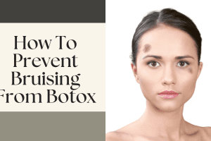How To Prevent Bruising From Botox: Best Tips 2022