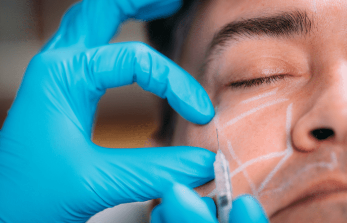 What to know before getting fillers