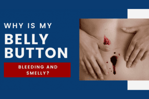 Why is my Belly Button Bleeding and Smelly? 2022