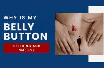 Why is my Belly Button Bleeding and Smelly? 2022
