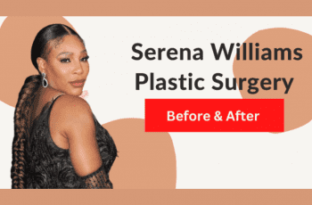 Serena Williams Plastic Surgery: Before & After 2022
