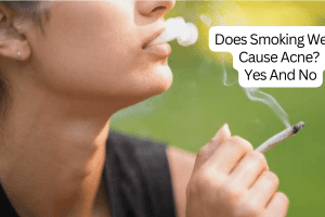 Does Smoking Weed Cause Acne? Yes And No 2022